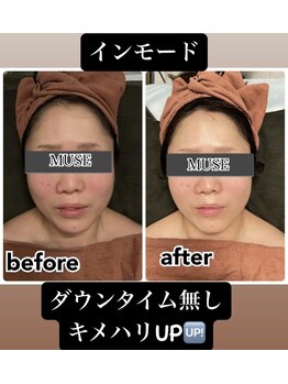 ミューズ よもぎ蒸し(MUSE)/◆インモード◆