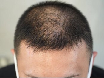頭皮お悩み改善専門店 ウームの写真/印象を変えたい！【髪の毛・頭皮のお悩み解決サロン】頭頂部・髪のボリュームなどのお悩みにアプローチ！