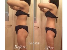 アプローズ(APPLAUSE)