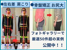 チャラク(charaku)の雰囲気（肩こり・腰痛・スタイル悪化原因を「見える化」変化多数フォトへ）