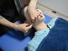 サロン ド ハリッシュ(Salon de HARISH)/美容鍼でキュッと小顔美人に♪