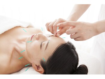 りっつ鍼灸院/キュッとリフトアップ！美容鍼