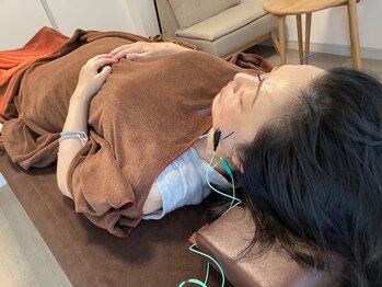 ハリファ鍼灸院 横浜関内院(HariFa鍼灸院)/美容施術/美容鍼