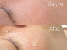 シス(sis)/フェイシャルwax