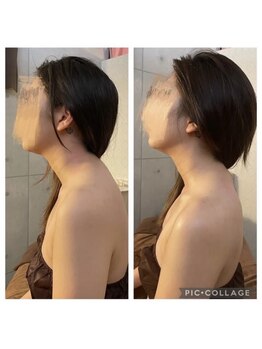 ニアベル(Nia Belle)/頚椎ケア