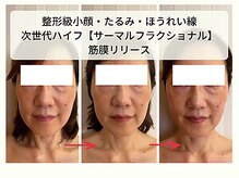 ムーンアンドアース(moon&earth)の雰囲気（小顔・たるみ・ほうれい線ケアメニュが充実！筋膜/サーマル◎）