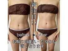 エヌボーテ(N. beaute)/before→after8回目