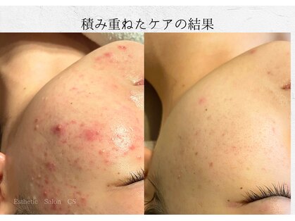 オートクチュール エステティックサロン シーズの写真