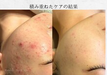 オートクチュール エステティックサロン シーズ