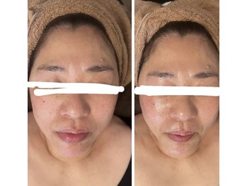 マオ(mao)/☆1回Before→after☆