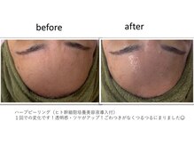 エステアンドタイ古式整体ティーダの雰囲気（人気の剥離しないハーブピーリングでごわつき・くすみケア♪）