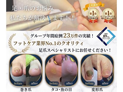 ドクターネイル爪革命 札幌本店の写真