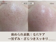レガロビューティクリエイションズ桜川店/褒められ素肌│毛穴ケア