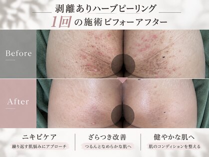 スリジエ ボーテ(cerisierBEAUTE)の写真