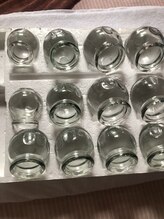 スマイル(SMILE)/カッピング