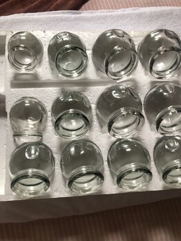 スマイル(SMILE)/カッピング