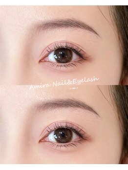 アミーラ(Amira)/フラットラッシュ上+下