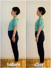 美容整体プラスキュー五反田/姿勢矯正・猫背改善