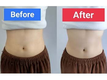 ブランフルレット 麻布十番