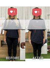 上六ミューク整体院/肩の高さが違う！