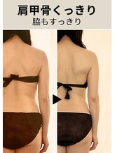 ディアメデル(Diamedel) BEFORE AFTER