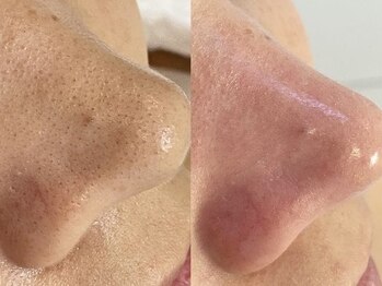 もんたわ鍼灸整骨院/【フェイシャルコース】