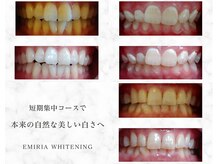エミリアホワイトニング(EMIRIA WHITENING)