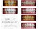 エミリアホワイトニング(EMIRIA WHITENING)の写真