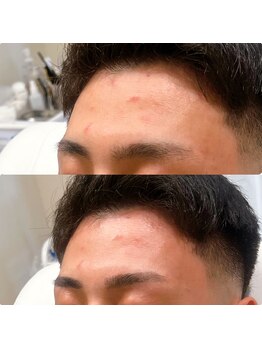 ホワイトアイ 甲府上石田(WHITE EYE)/【山梨/甲府】メンズ眉毛