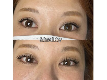 ムーンアイビューティープラス(moon eye beauty+)の写真