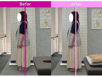 八女整体院/~姿勢改善~肩こり