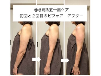 ビーオリビン(B-olivine)/上半身集中ケア　肩こり/巻き肩