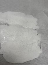 メイリリー(Maylilly)/産毛除去・毛穴ケア・美肌脱毛