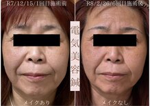 鍼灸院オリーブ(鍼灸院OLIVE)