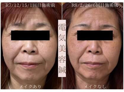 鍼灸院オリーブ(鍼灸院OLIVE)の写真