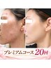 【肌改善&小顔】潤いツヤ肌★美白・毛穴ケア 8,800円→6,800円