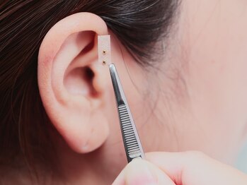ダイヤモンド 豊中店(DIAMOND)/耳つぼは身体に優しい施術です