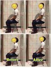 くすの樹接骨院 整体院 鳥栖院/整体/骨盤矯正ビフォーアフター