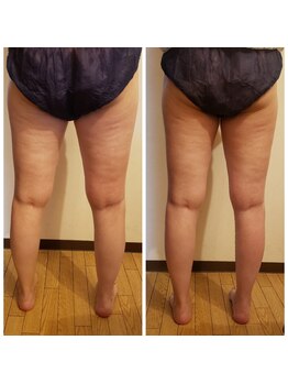 ロージーハピネス(Rosy happiness)/足を細くしたい方