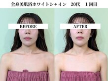 サンビ(SANBI)/20代　１回目