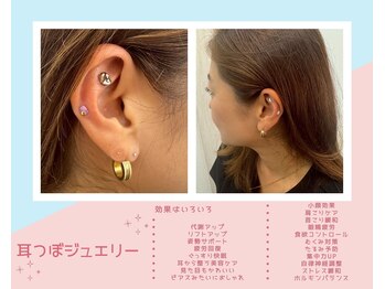 丸太町骨盤整骨院 鍼灸院/耳つぼジュエリー