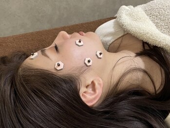 ボニー(Bonnie)/【美容鍼灸】