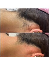 ジョアアンジェ 京橋店(joie ange)/うなじワックス