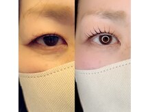 グロウビューティー(grow beauty)/