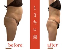 ウィズルーチェ 神栖店(with luce)/痩身効果★ダイエットに終止符を