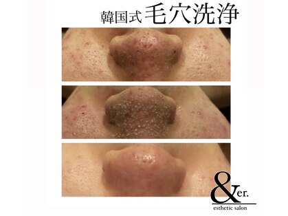 岡山県のブラジリアンワックス ワックス脱毛が人気のエステサロン 口コミ人気ランキング ホットペッパービューティー