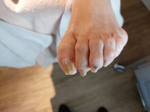 爪切り屋 足楽/６０代女性◆曲がるあしゆび