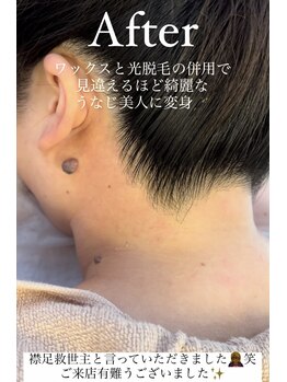 エリス(ELISSE)/ワックスと光脱毛のダブル効果