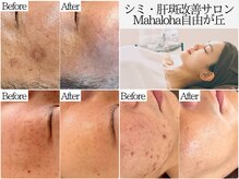 マハロハ 自由が丘(Mahaloha)