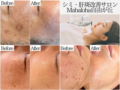 マハロハ 自由が丘(Mahaloha)の写真